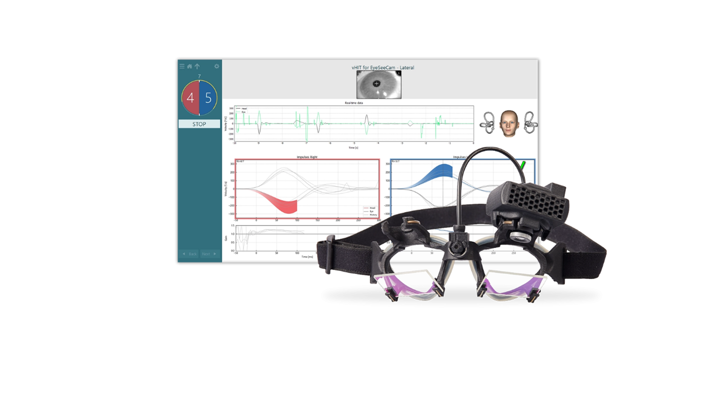 The Video Head Impulse Test